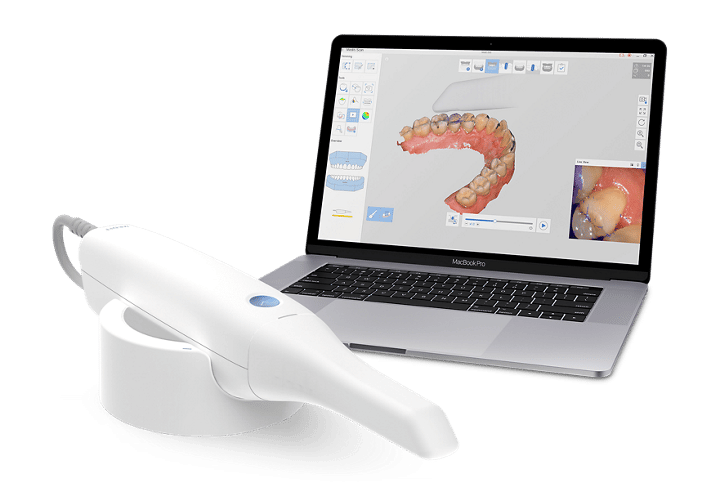 Intraoral scanners Brand comparison, uses, and more Dandy