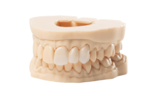 Dental Impressions Types and Materials | Dandy