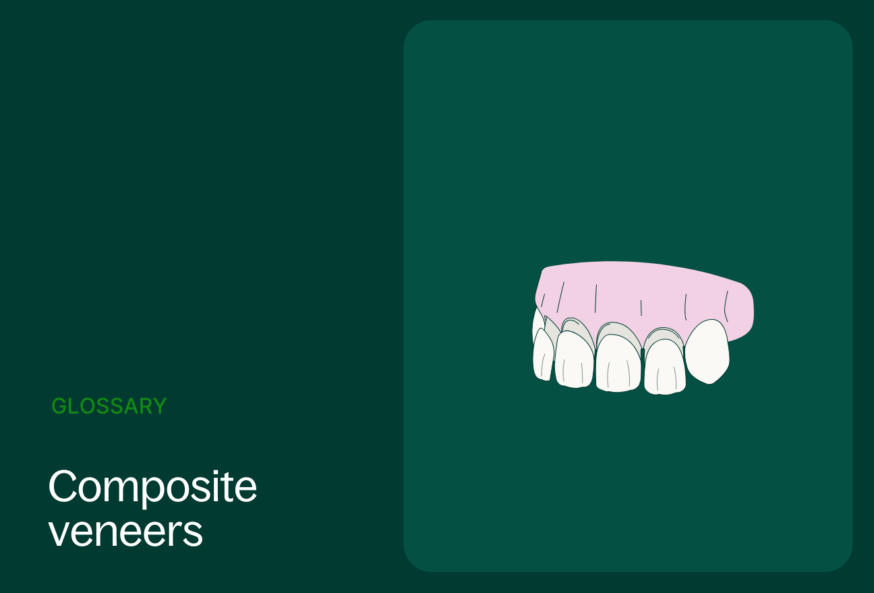 glossary of composite veneer