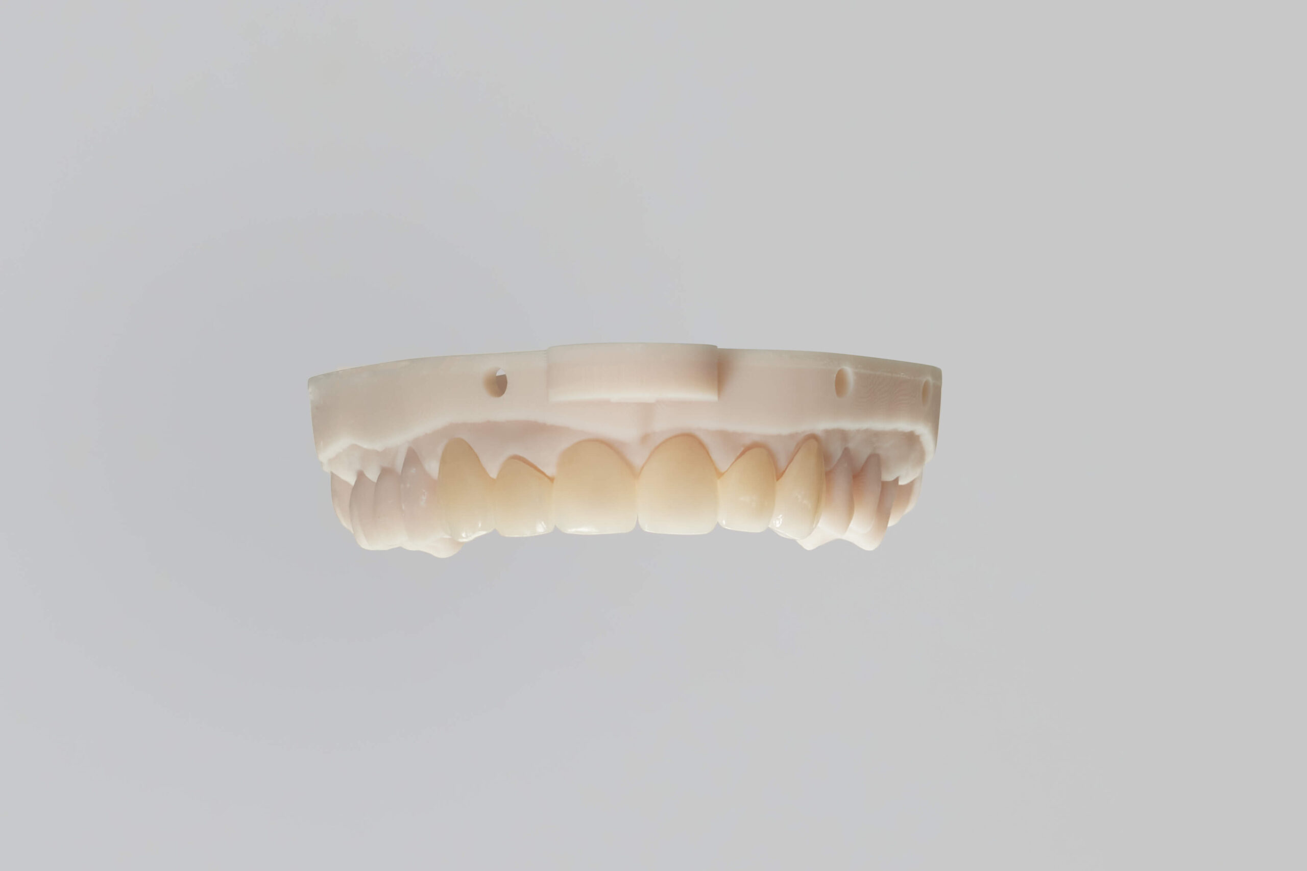 emax crowns