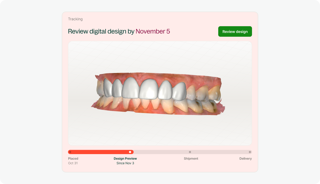 Eliminate try-in visits with design approval